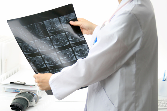 レントゲンを見る医者